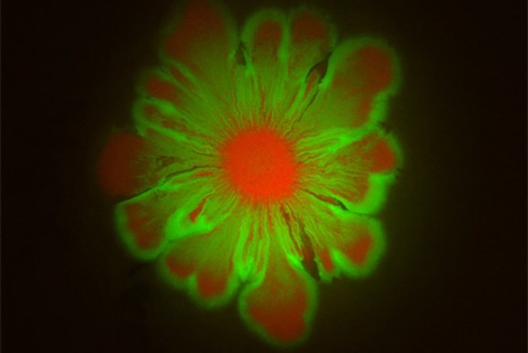 Combination Of Bacteria Forms Stunning Flower-Like Patterns