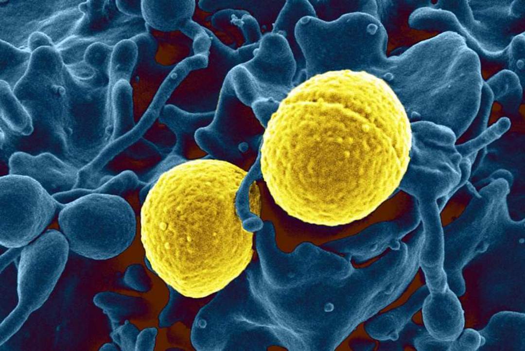 Drug-resistant Infections As Big A Threat As Climate Change