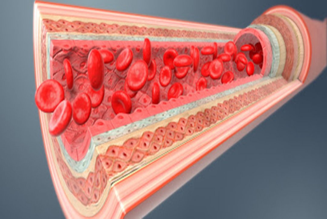 A New Substance Aims To Prevent Vascular Calcification