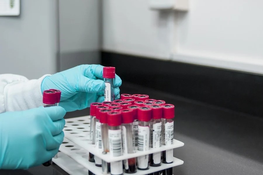 Researchers claim new blood test can find 50 types of cancer
